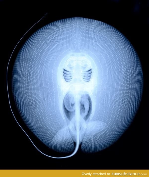 X-Ray of a Stingray