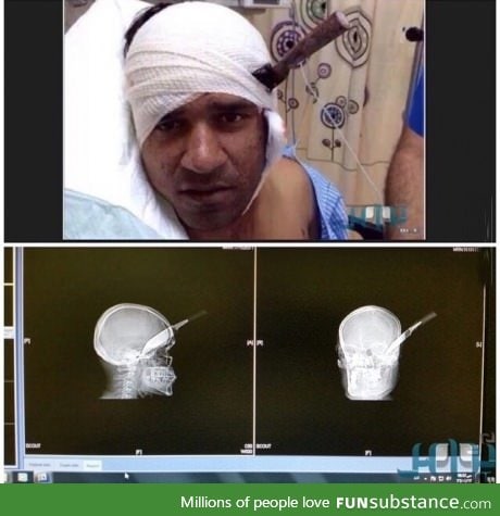 Man survives knife to the head