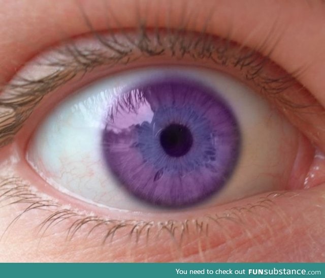 This is the Alexandria's Syndrome of the violet eyes!