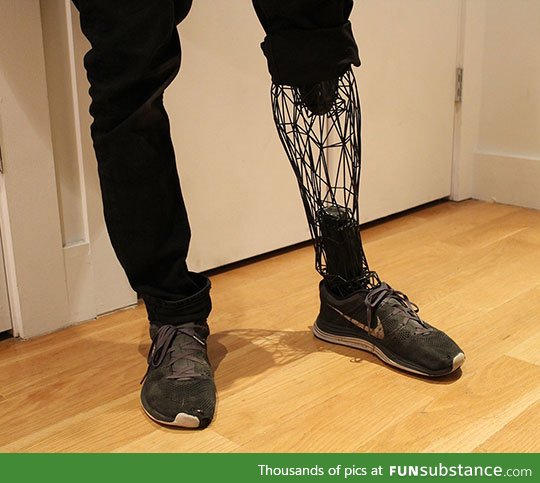 3D printed leg prosthesis
