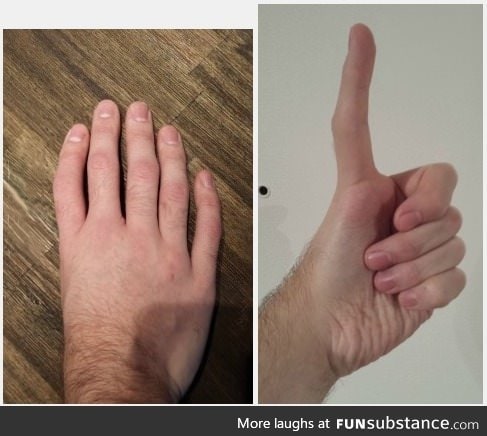Five fingers, no thumb