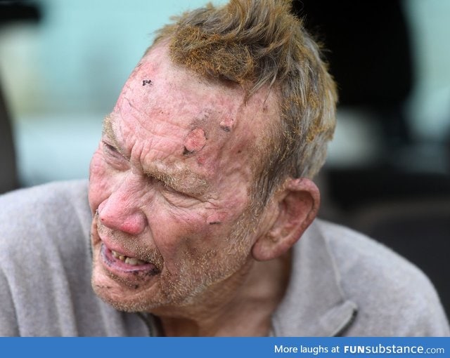 This hero is 82 year old Perry Boore. He was severely burned while trying to rescue dogs