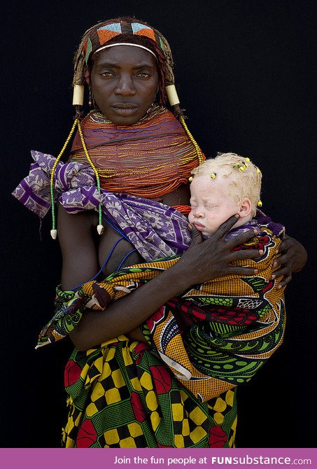 African tribeswoman with her albino baby