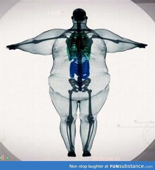 Nobody is "big-boned". Please, take care of yourselves