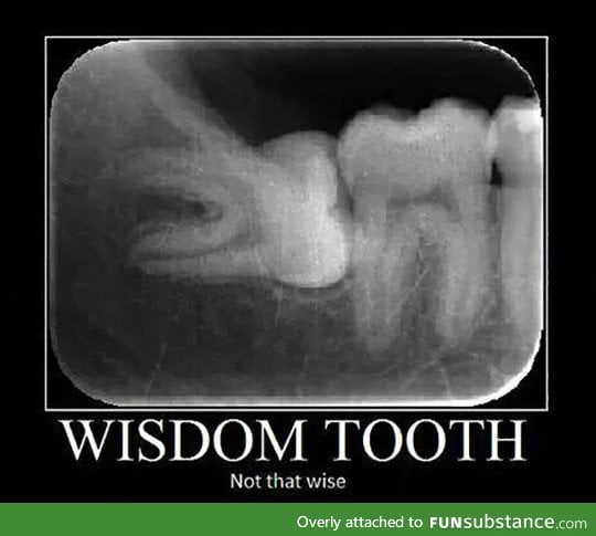 Why do wisdom tooth even exist?