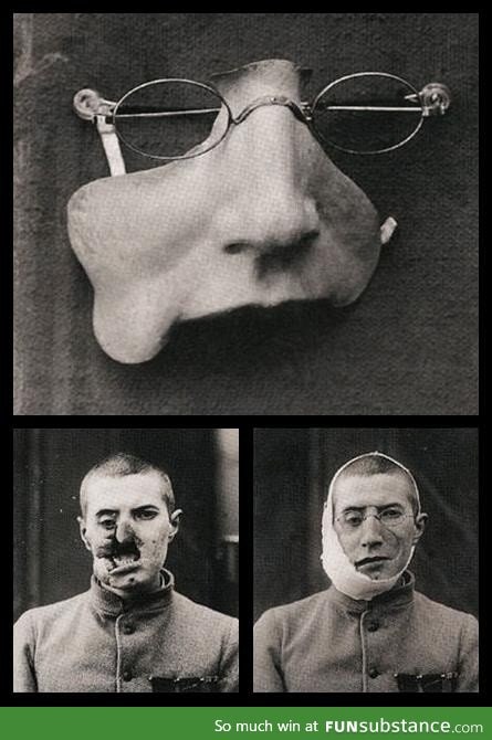 A prosthetic face plate from WWI