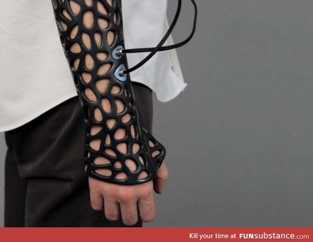 A 3D-printed casts allows broken bones to heal 40% faster than traditional plaster casts