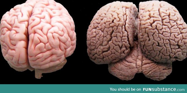 A human and a dolphin brain