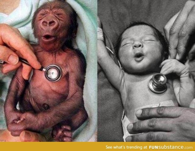 Baby gorilla and baby human reacting to a cold stethoscope