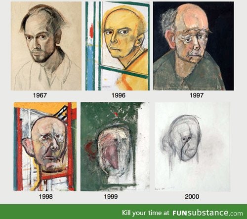 Self-portraits of William Utermohlen, chronicling the progression of his Alzheimer's