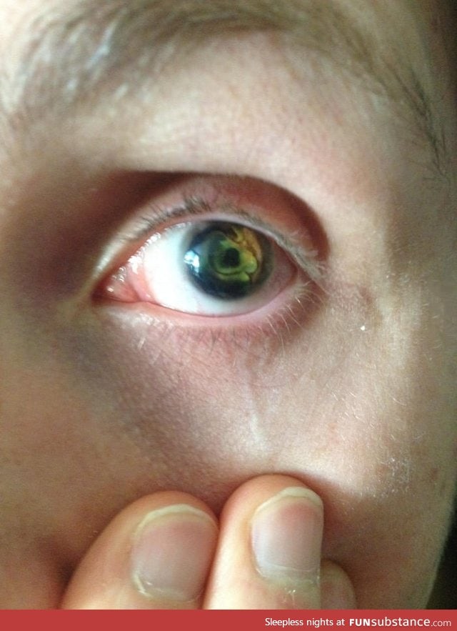 I think my blind friends eye is amazing!
