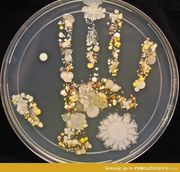 A microbiological culture of an 8-Year old's handprint after playing outside