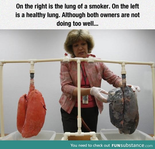 Lung of a smoker vs. Healthy lung