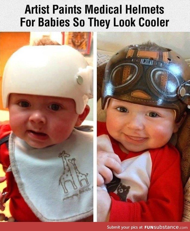 Cool helmet for babies with medical needs