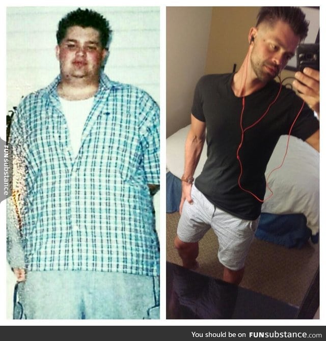 This is what losing 160 pounds looks like