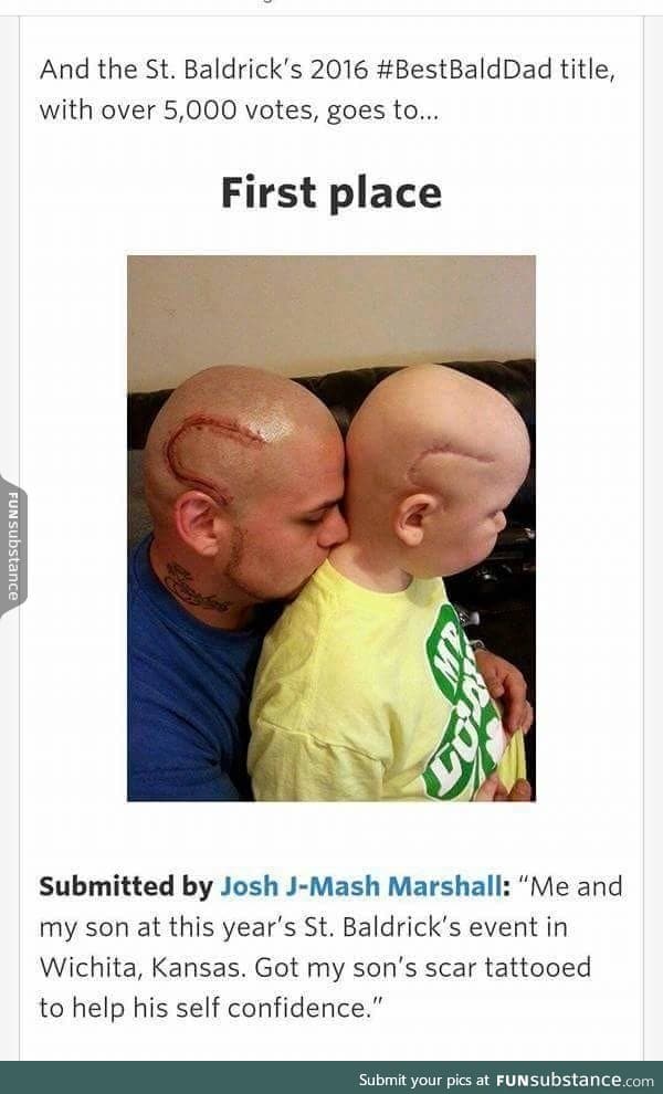 Best bald dad award goes to this guy!