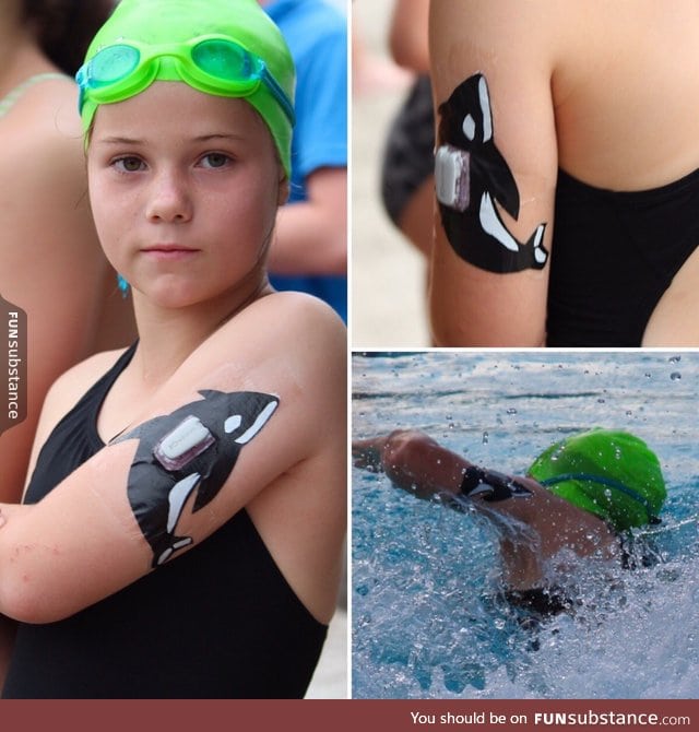 Dad decorates his daughters diabetes device using dollar store tape for her swim meet