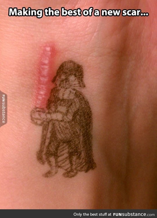 Scar wars, a new hope