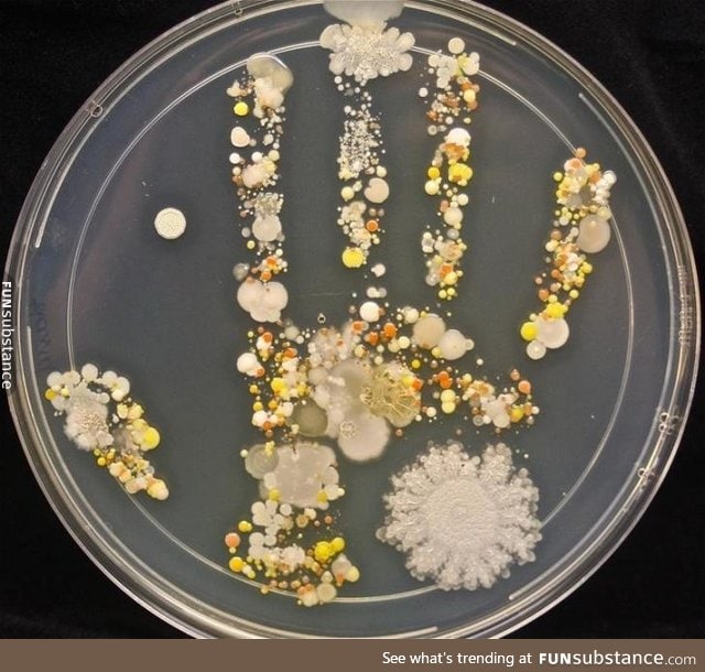 An 8-year-old's bacteria-filled handprint