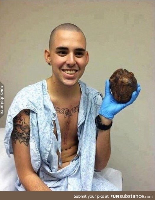 A man holding his old heart following a succesful heart transplant surgery