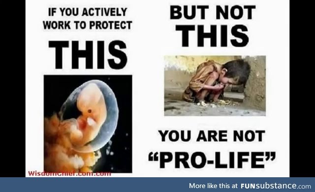 "pro-life" my ass