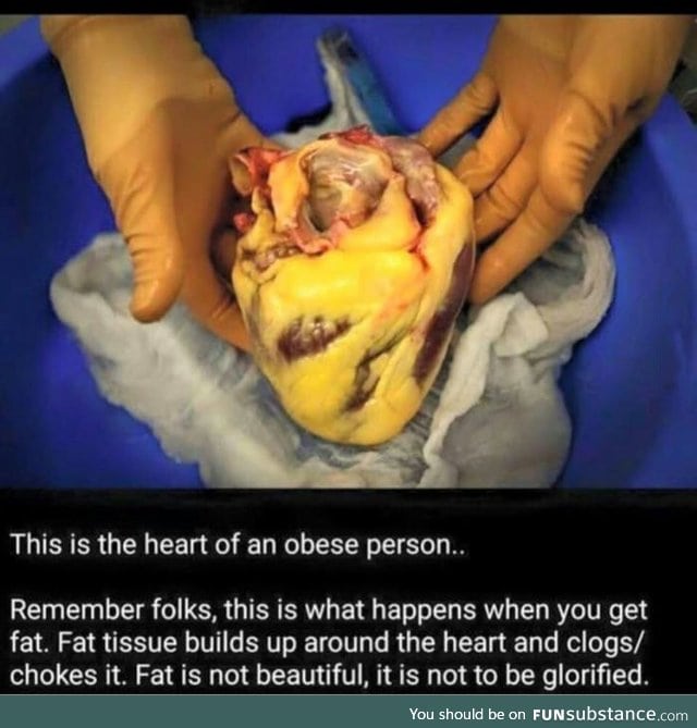 Fat is not to be glorified