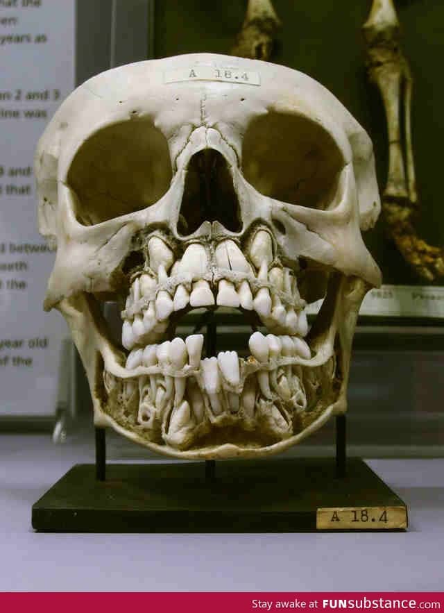 The skull of a child is terrifying with all that teeth