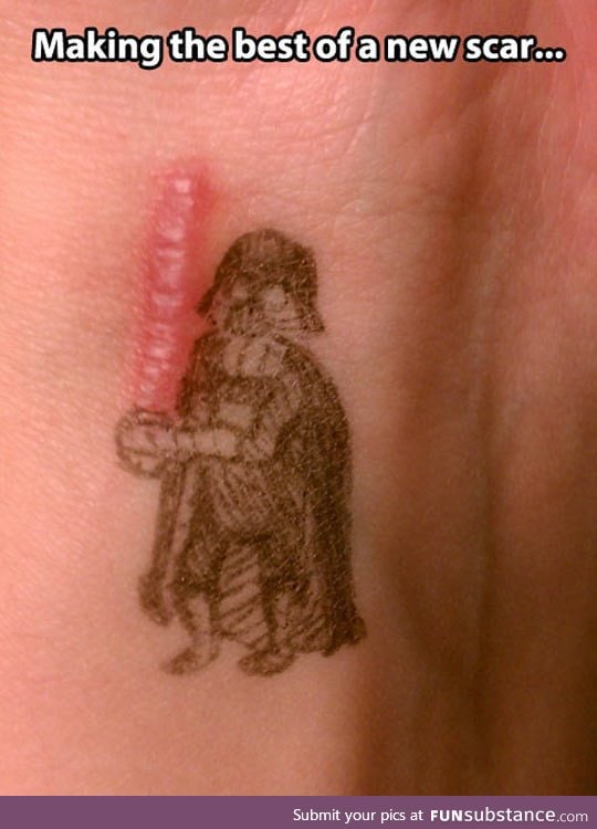 Scar wars, a new hope