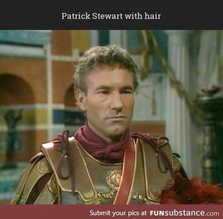Patrick Stewart with hair