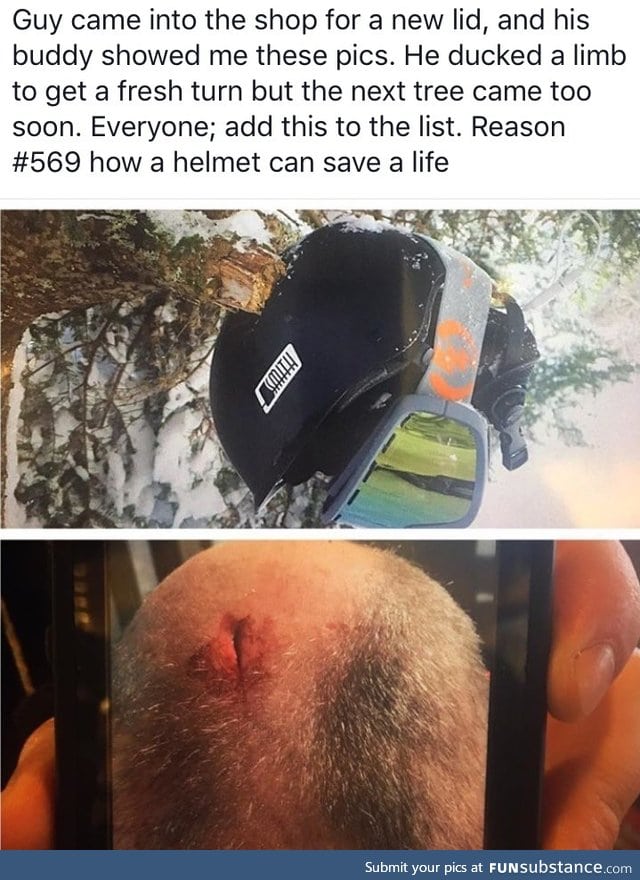How a helmet can save your life