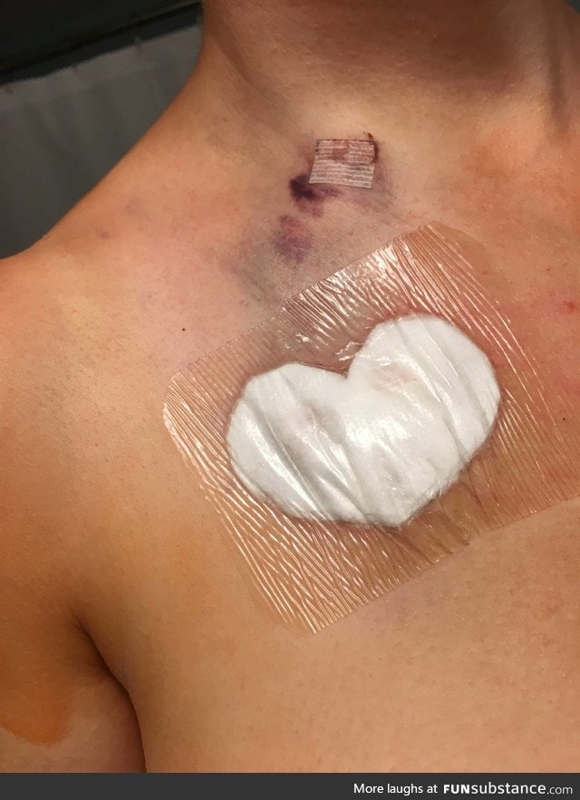 When your surgeon really loves you, makes you a heart-shaped bandage