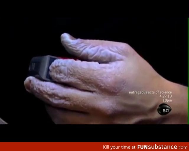 This is what 10 days underwater does to your hands