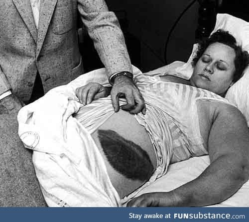 Ann Hodges. The only person in history to be struck by a meteorite. (1954)