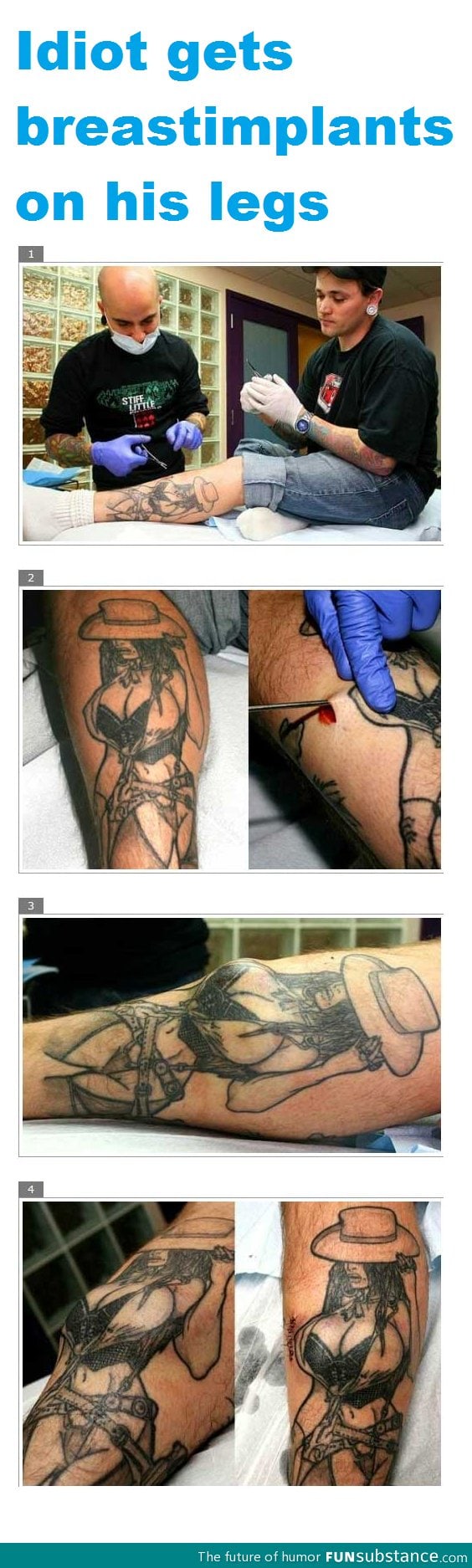 Breast implant on leg tattoo