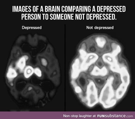 When a brain is depressed