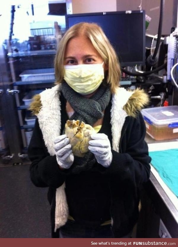 A transplant recipient holding her own heart