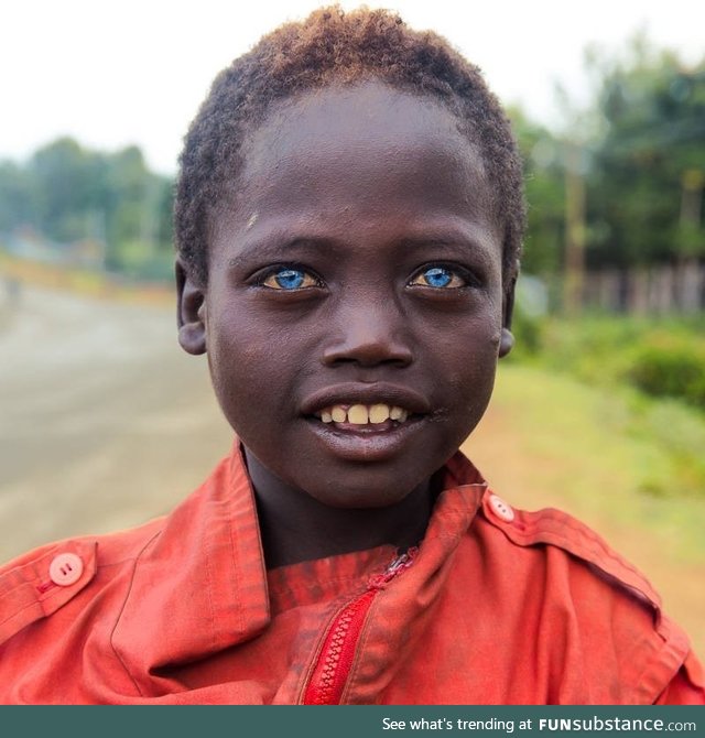 Ethiopian boy with blue eyes on the streets of Jinka (no photoshop)