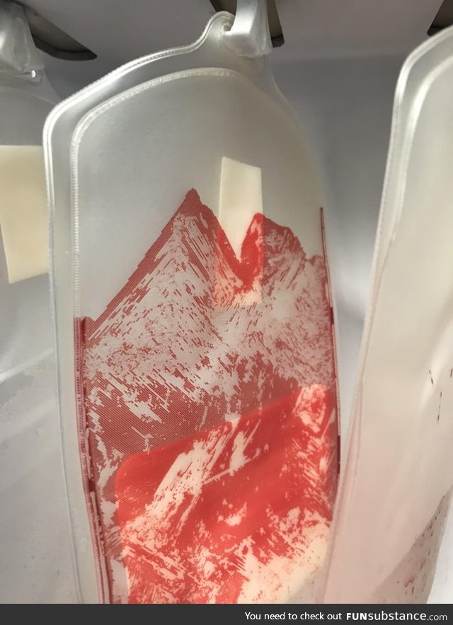This empty bag of blood looks like a snowy mountain top