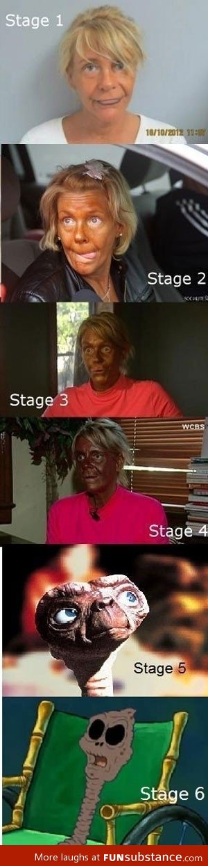 The stages of tanning