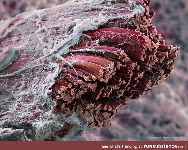 Muscle tissue through electron microscope