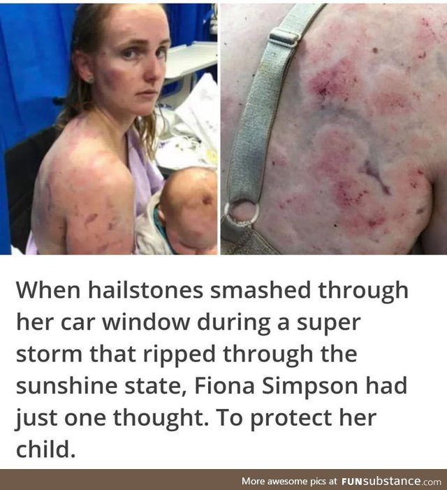 Mother puts her life on the line to protect her baby
