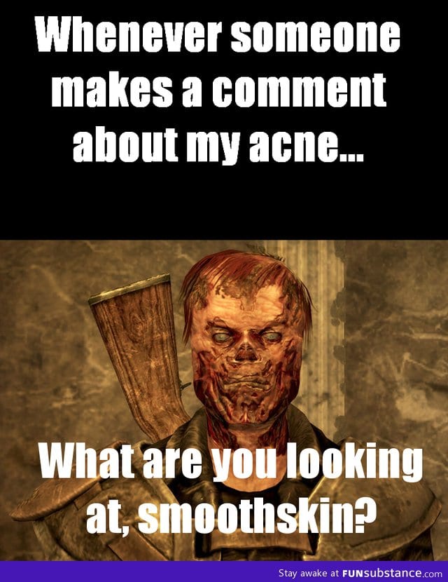 Acne sucks