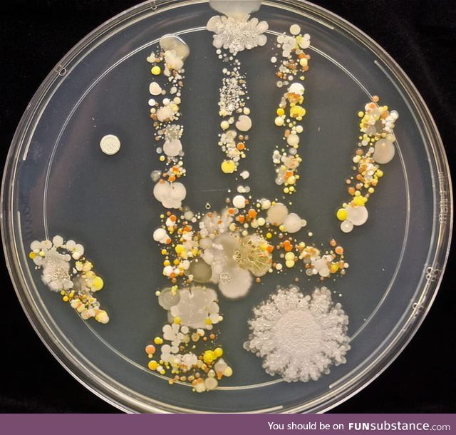 An 8 year old's microbiological handprint after playing outside