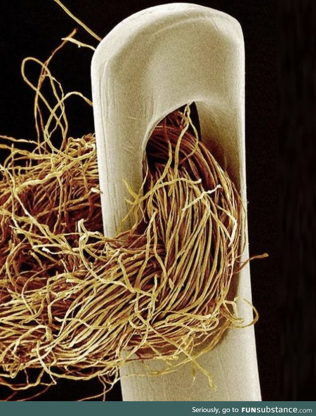A needle and thread under an electron microscope