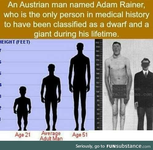 Adam Rainer, the Giant Dwarf