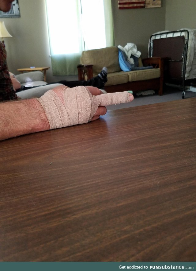 My dad tore a ligament in his hand. For the next two months he gets to flip everyone off