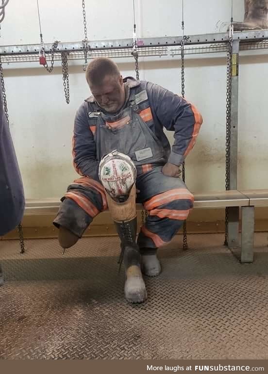 Coal miner continues to work after losing a leg. My hard hat is off to you sir