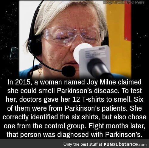 Woman with the ability to smell Parkinson's, it's a medical mystery