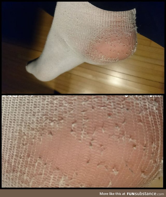 What do you mean by hole in my sock?