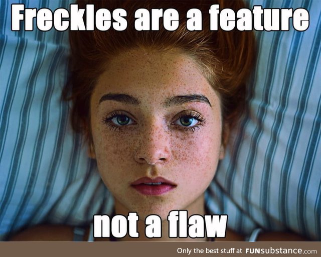 Freckles are pretty